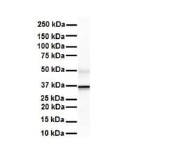 ZFP36L1 Antibody, Novus Biologicals 100 &mu;L | Buy Online | Novus Biologicals | Fisher Scientific
